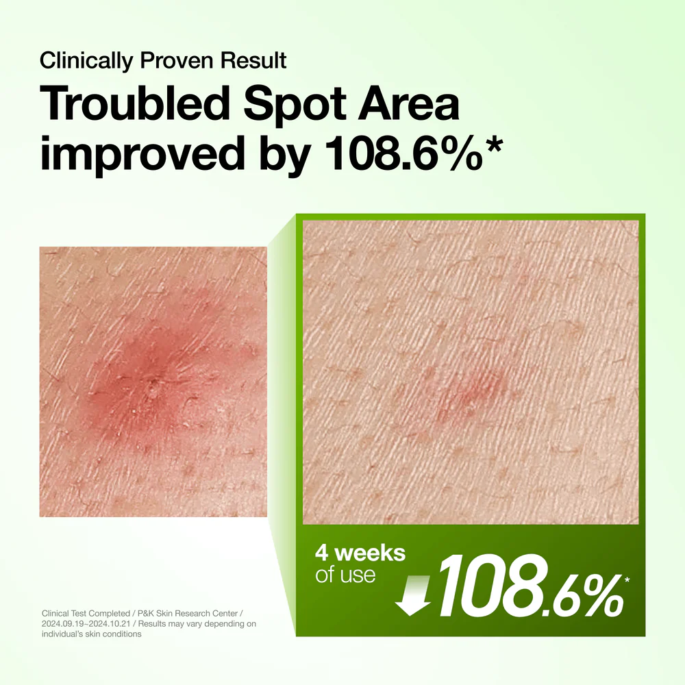 Anua Azelaic Acid 10 Serum - Consumer Study Results