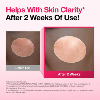 Anua Niacinamide 10+ TXA 4 Serum - 3 Ways to Transform Your Skin dark spot glassy glow texture