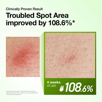 Anua Azelaic Acid 10 Serum - Consumer Study Results